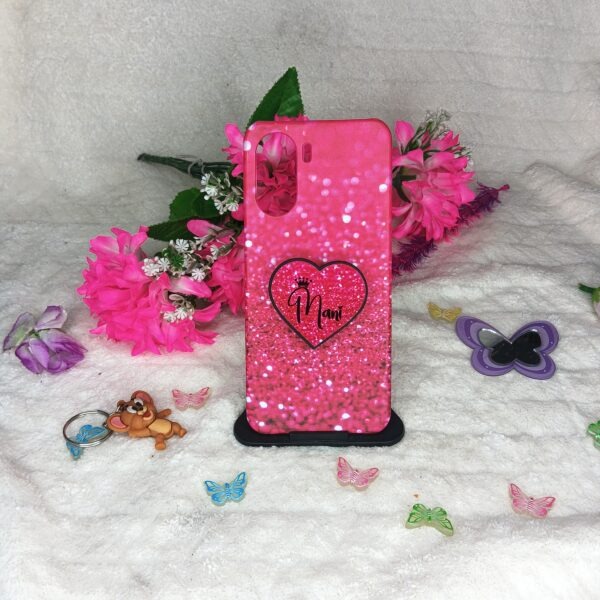 ✨GILLTERCASE CUSTOMIZED DESIGN PHONE CASES ARE HERE! 📱🔥Make your phone case truly YOURS! 😍🎨 Custom Photo • Name • Logo • Design✨ Premium & Stylish Look🛡️ Strong Protection🎁 Perfect Gift for Friends & Family🚚 Delivery AvailableDMW CASE STORE 💙#CustomizedCase #CustomPhoneCase #PersonalizedCase #CustomCase #PhoneCase #PhotoCase #NameCase #CustomDesign #MobileAccessories #DMWCaseStore #Chennai #Trending #InstagramReels #ExplorePage #ViralReels